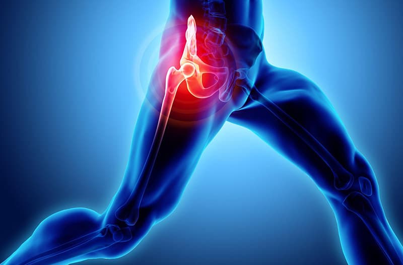 Hip Flexor Strain – an overview of what you need to know