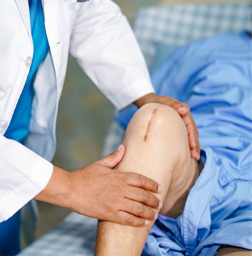 partial knee replacement surgery by a doctor