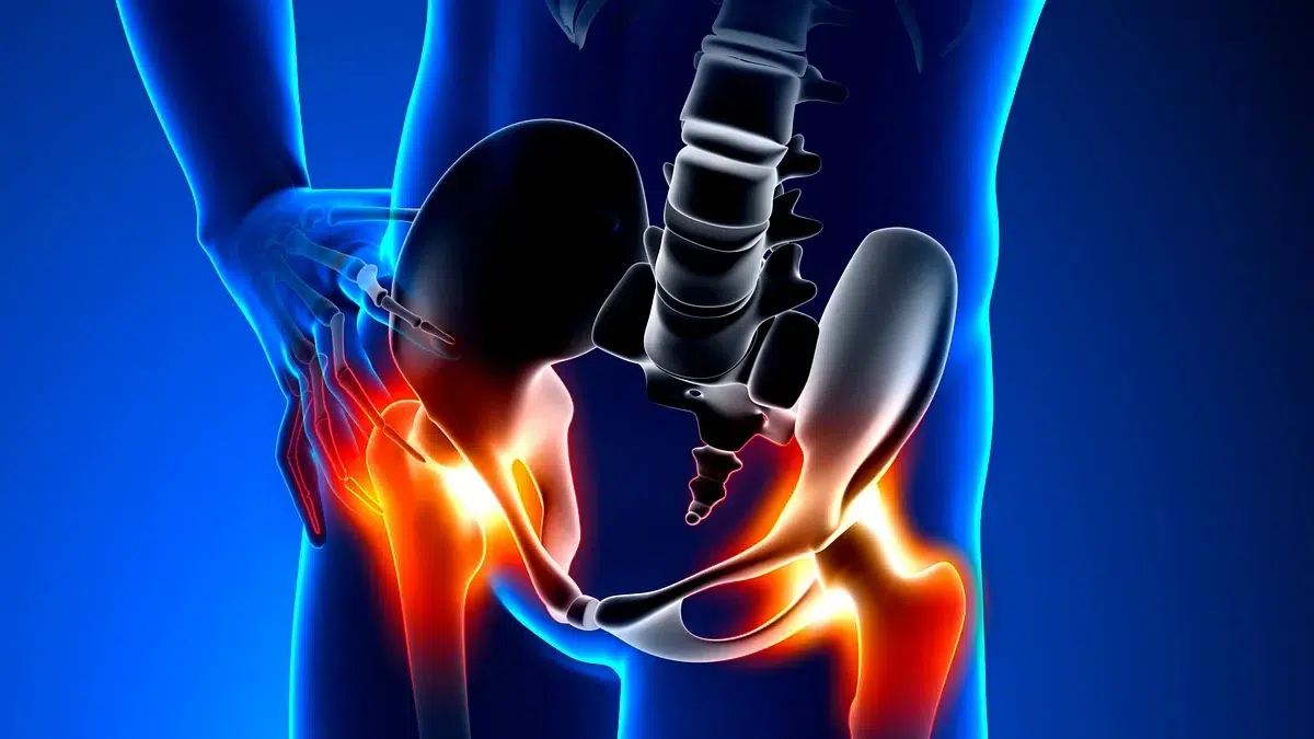 Is The Labrum Removed During Hip Replacement?