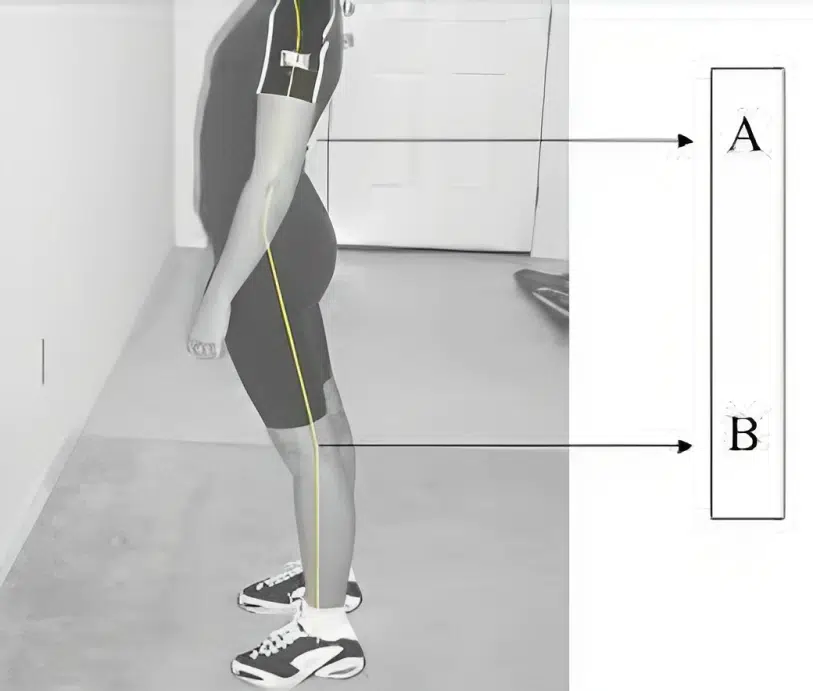 Is it possible to correct anterior pelvic tilt