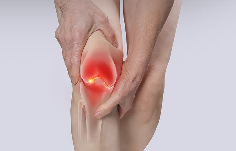 Knee Inflammation